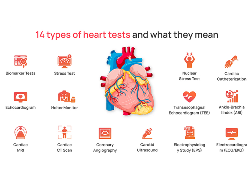 Heart Test Name List: Comprehensive Tests for a Full Heart Check-Up